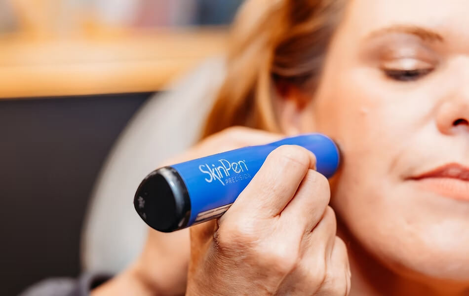 Cosmetic Dermatology showing skinpen microneedling